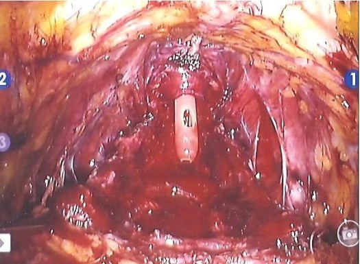 i keep telling myself....he that seeks revenge should dig two graves.....