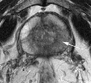 2005_12_14_15_52_33_706